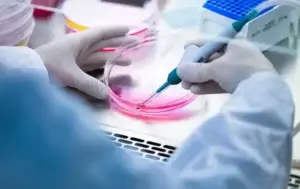 Стволовые клетки пересадка, Корея трансплантация стволовых клеток