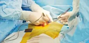 Трансплантация печени живой донор, Корея