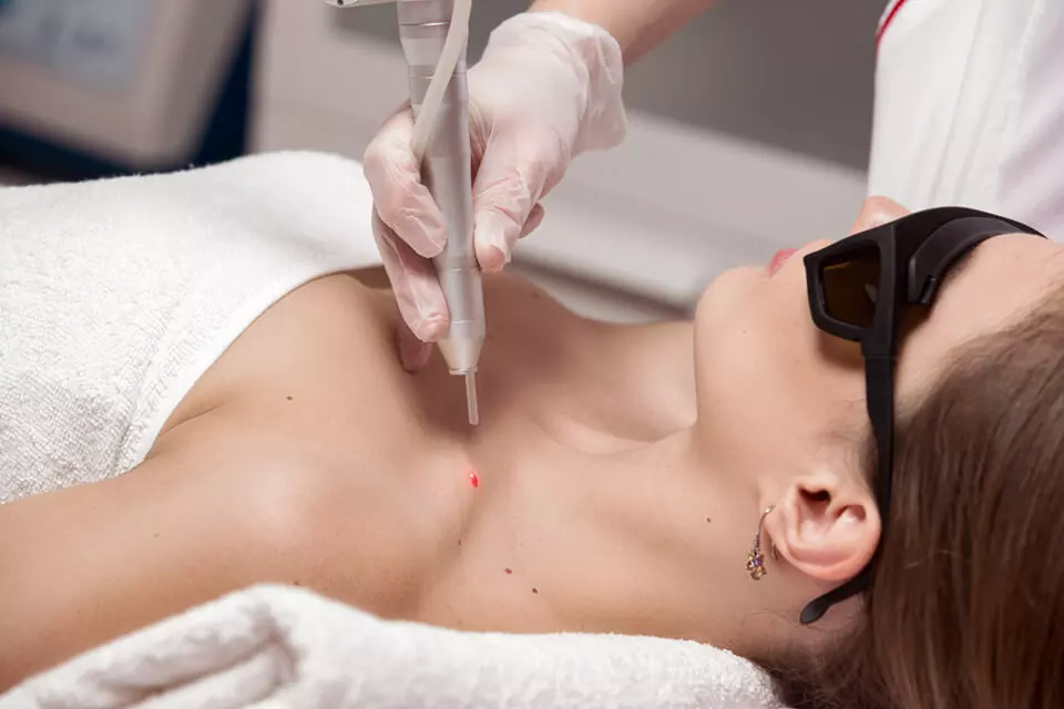 Лечение рака кожи Корея Меланома кожи за границей, меланома кожи лечить Корея