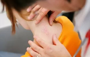 Псориаз Корея, лечение псориатических бляшек