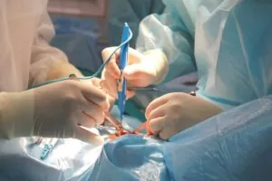 Варикоз Корея, лечить варикозное расширение за границей